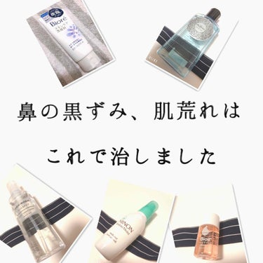 鼻の黒ずみ、毛穴が気になる方→2枚目
ニキビ、肌荒れが気になる方→3枚目
毛穴ケア、肌荒れのためのスキンケア完全版

洗顔→ビオレ　スキンケア洗顔料オイルコントロール
収れん化粧水→ドルックス　アストリ