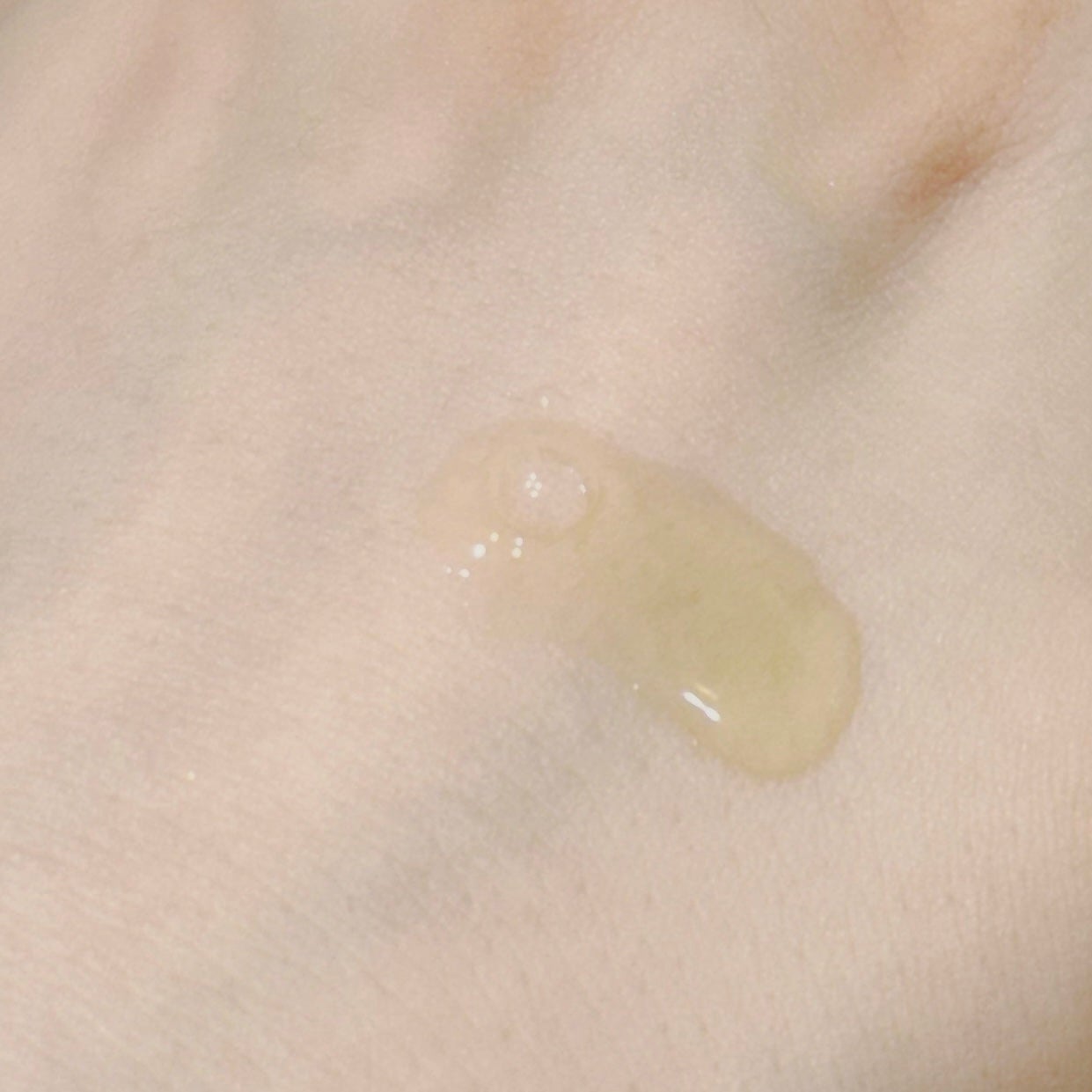 タカミ エッセンス5C+E/タカミ/美容液を使ったクチコミ(2枚目)