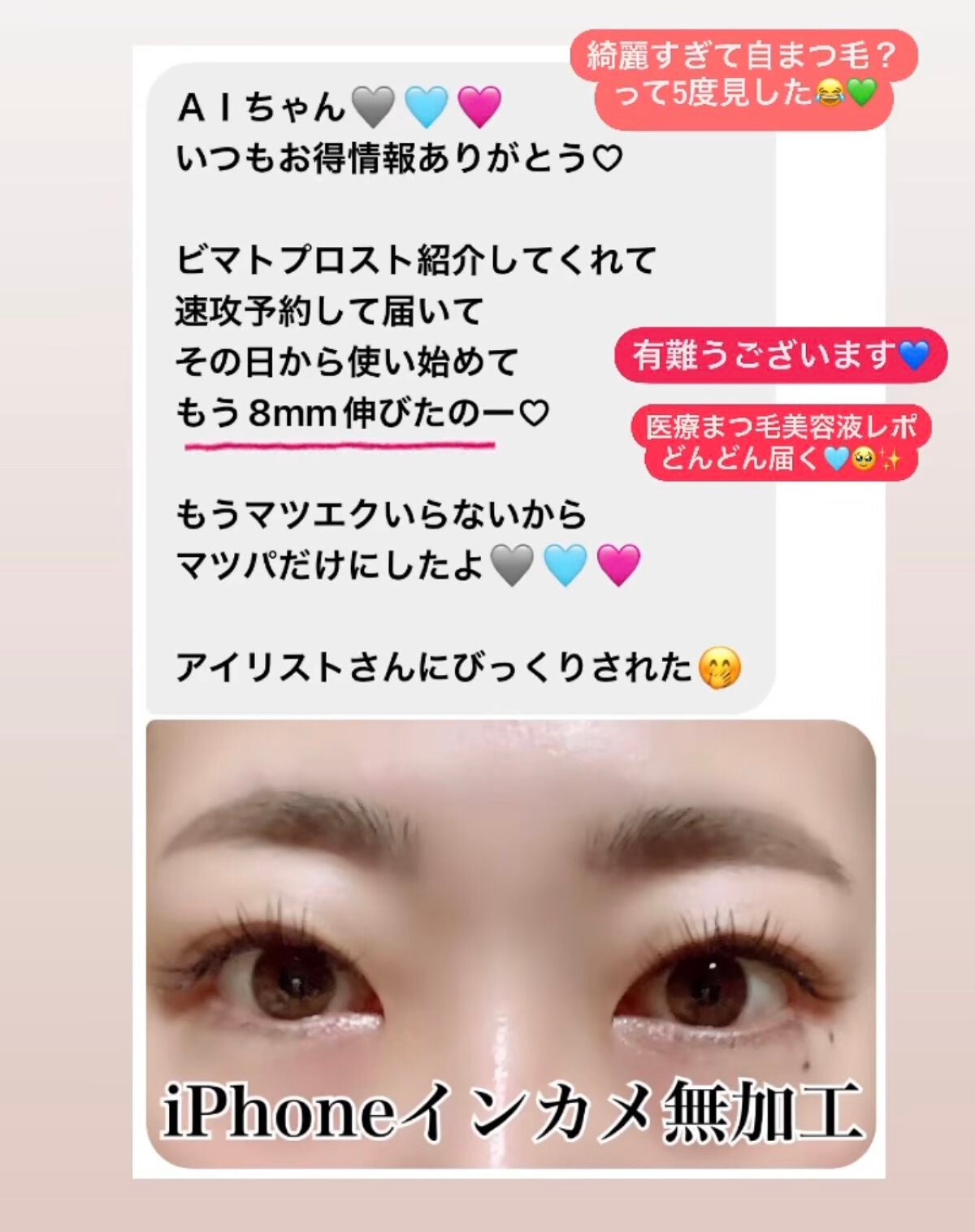 エグータム/アルマダスタイル/まつげ美容液を使ったクチコミ(3枚目)