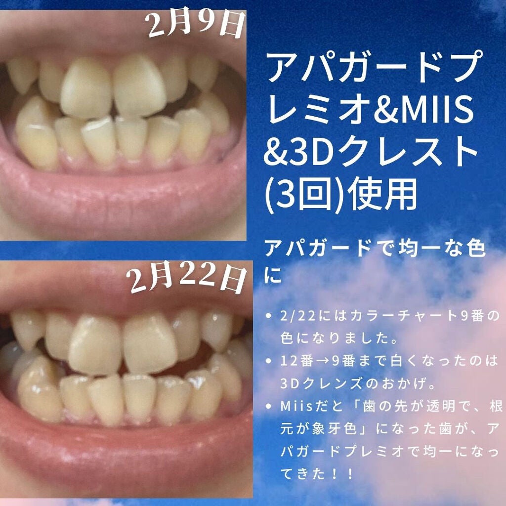 アパガードプレミオ/アパガード/歯磨き粉を使ったクチコミ(4枚目)