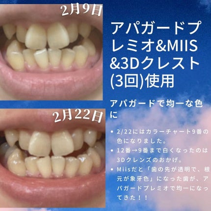 アパガードプレミオ/アパガード/歯磨き粉を使ったクチコミ(4枚目)