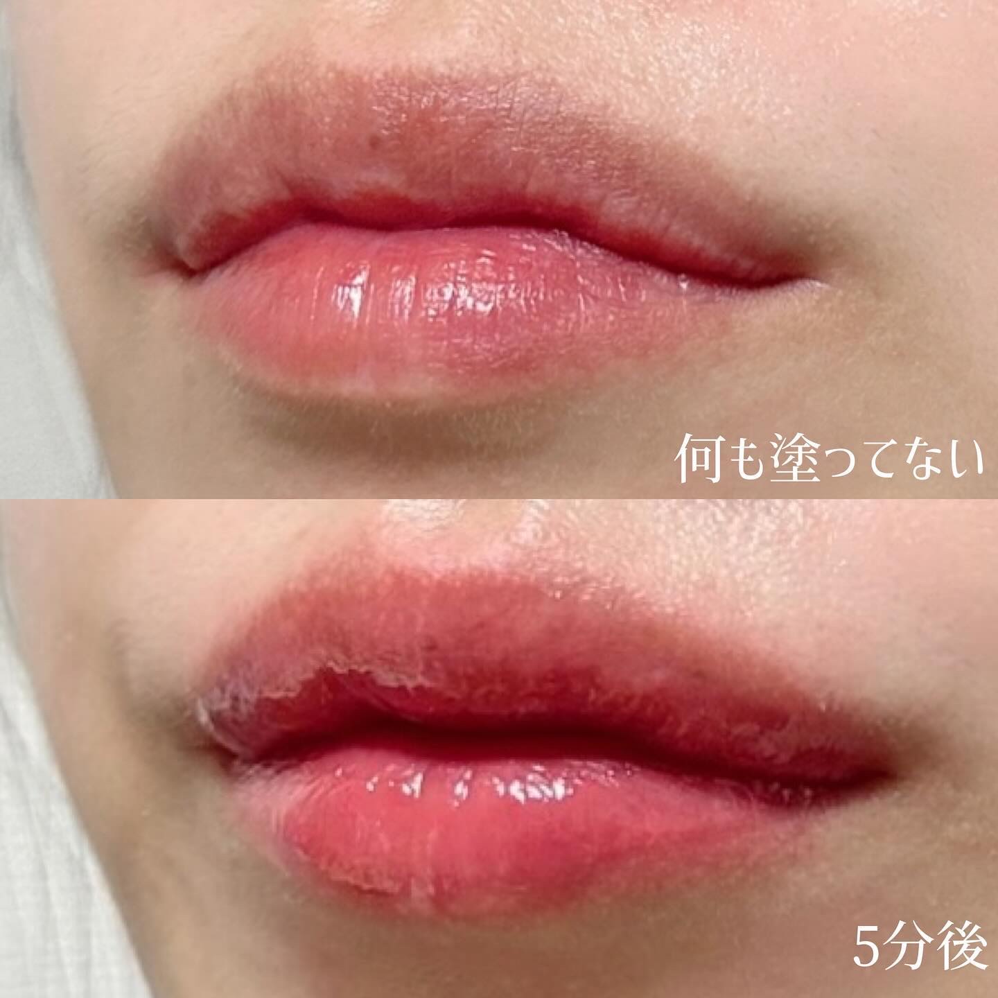 ボリュームリッププランパー/BANILA CO/リッププランパーを使ったクチコミ（3枚目）