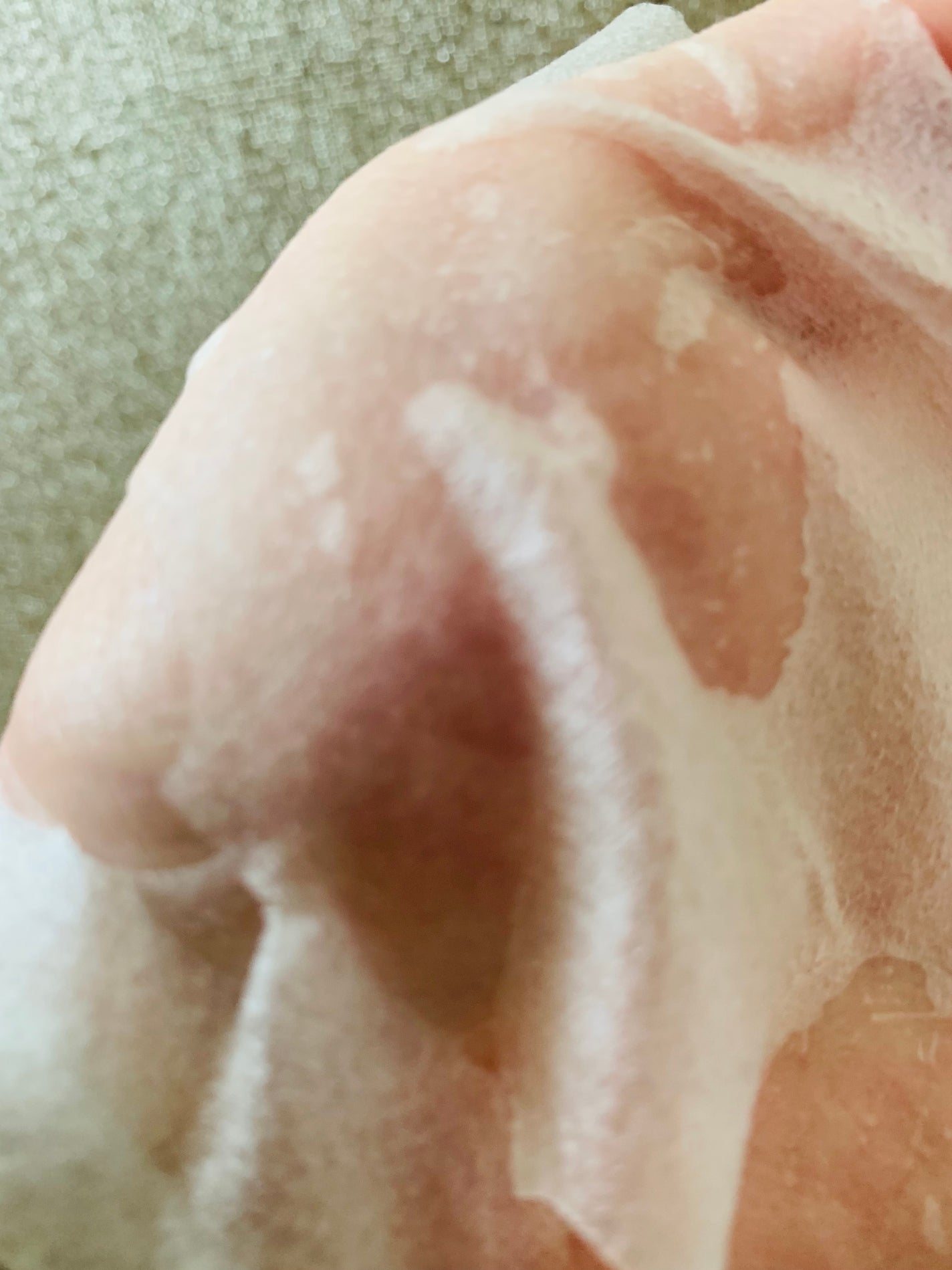 CICA デイリースージングマスク/VT/シートマスク・パックを使ったクチコミ(5枚目)