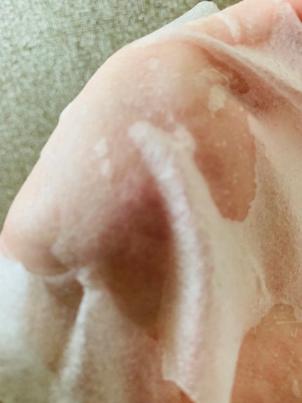 CICA デイリースージングマスク/VT/シートマスク・パックを使ったクチコミ(5枚目)