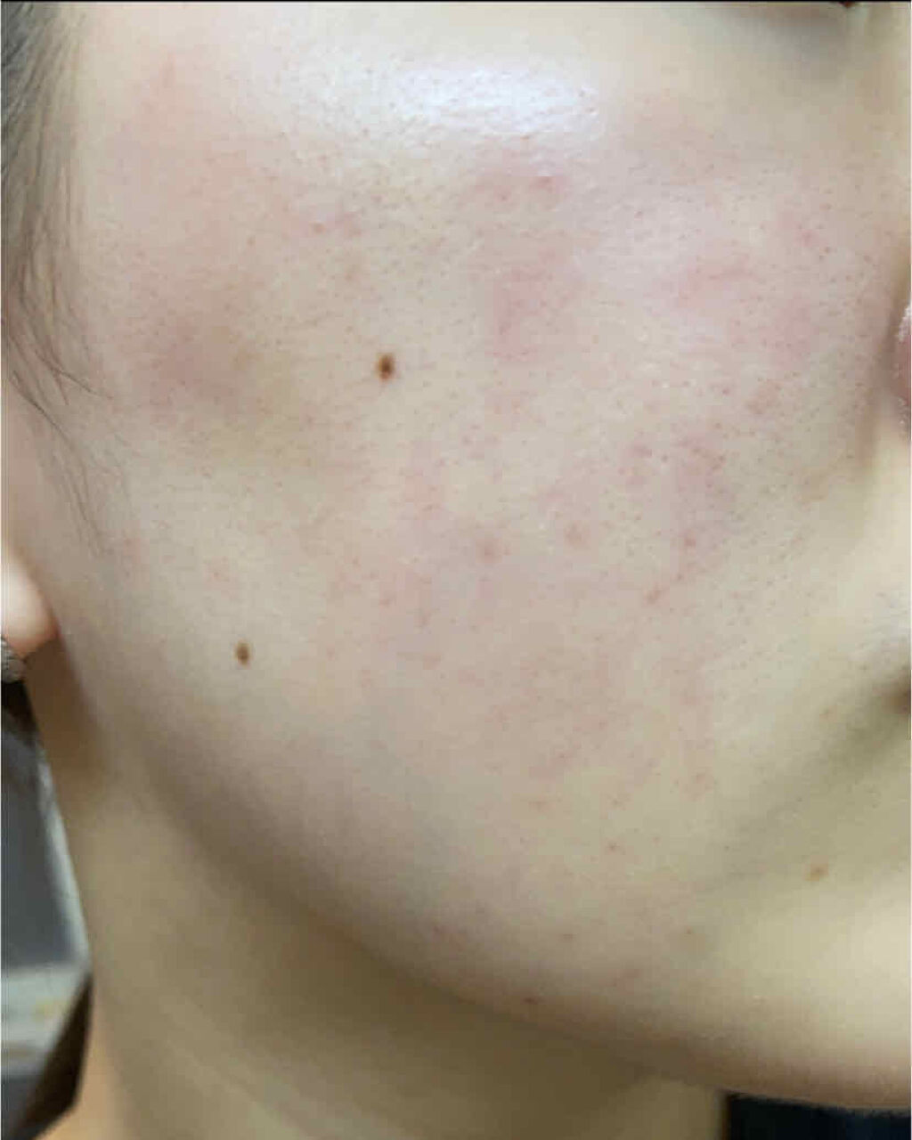 美白化粧水 VC/ちふれ/化粧水を使ったクチコミ（3枚目）