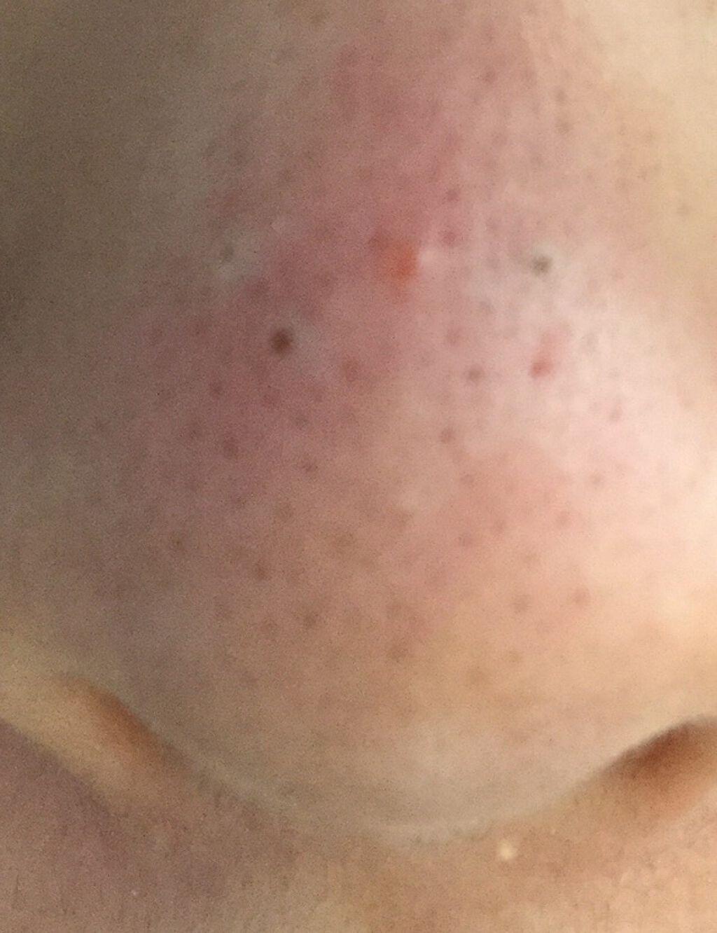 葵 on LIPS 「今回は私の悩みを解決していただきたく投稿させて頂きました。私の..」(3枚目)