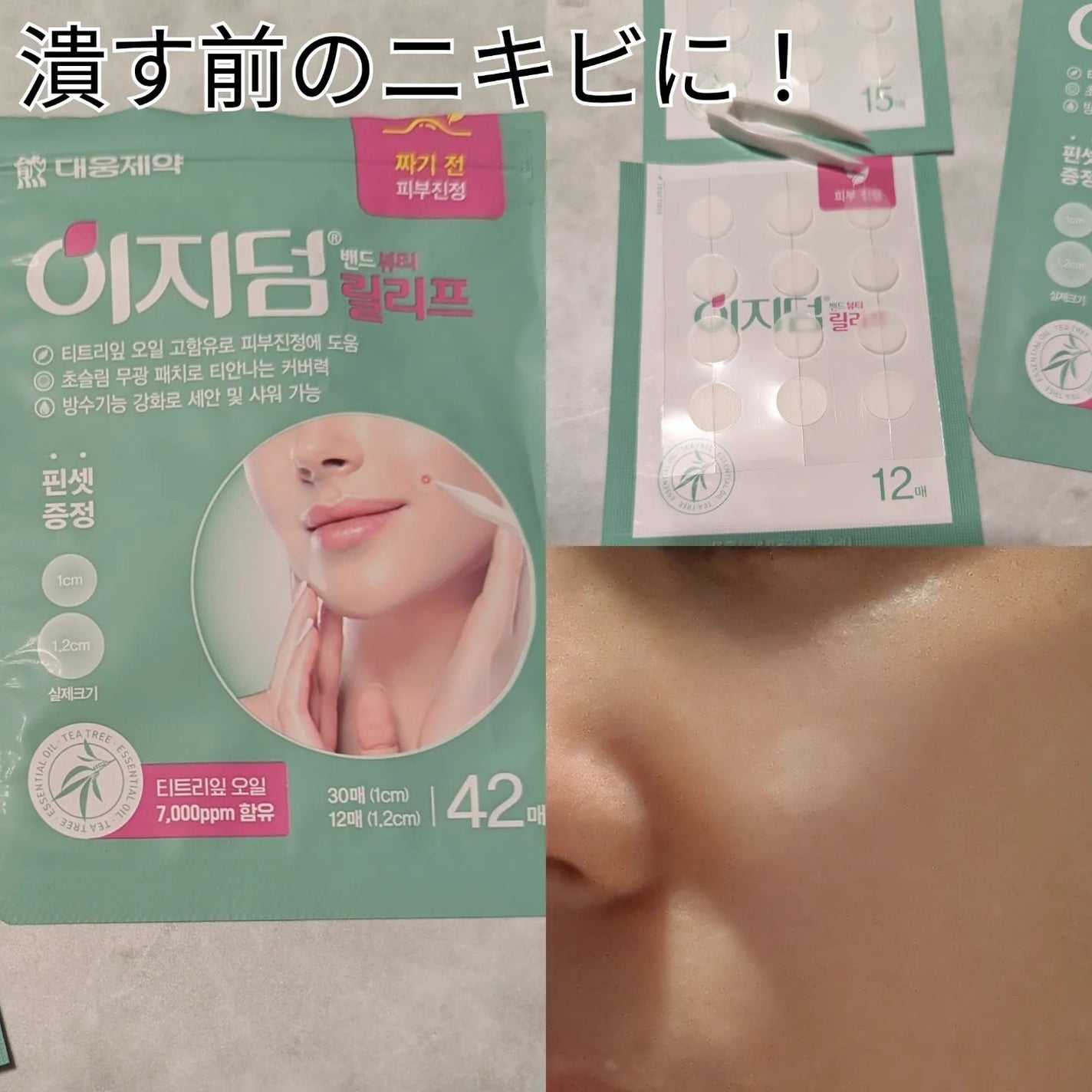 ビューティー スポットパッチ/イージーダムビューティー/にきびパッチを使ったクチコミ(3枚目)