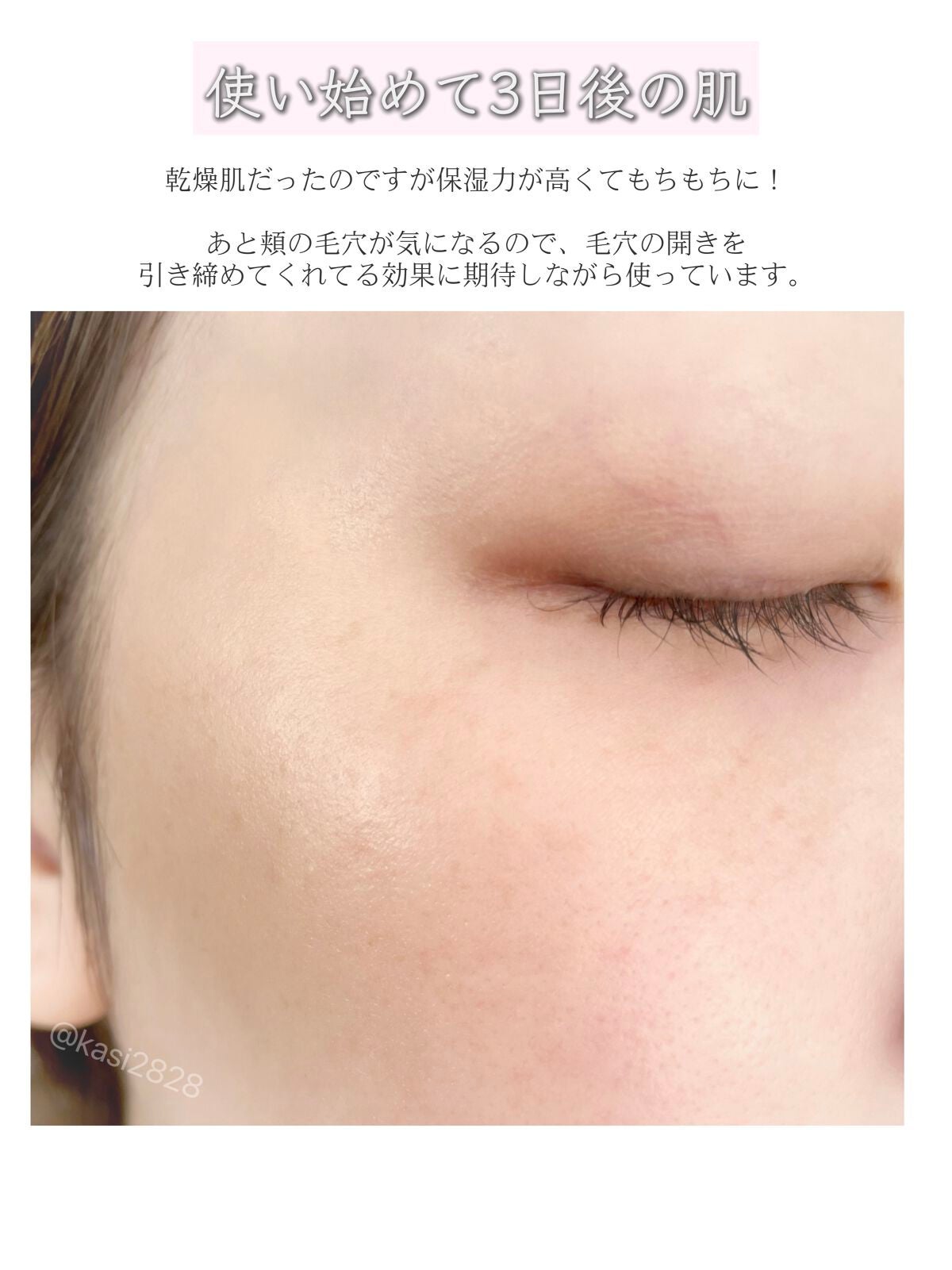 CICA クリーム/VT/フェイスクリームを使ったクチコミ(7枚目)