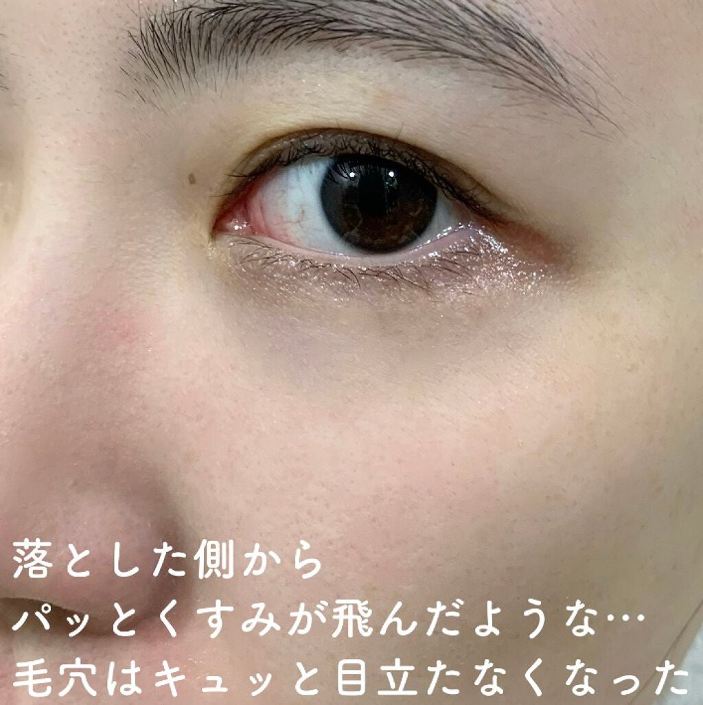 ドクターメディオン スパオキシジェル/ドクターメディオン/洗い流すパック・マスクを使ったクチコミ(9枚目)