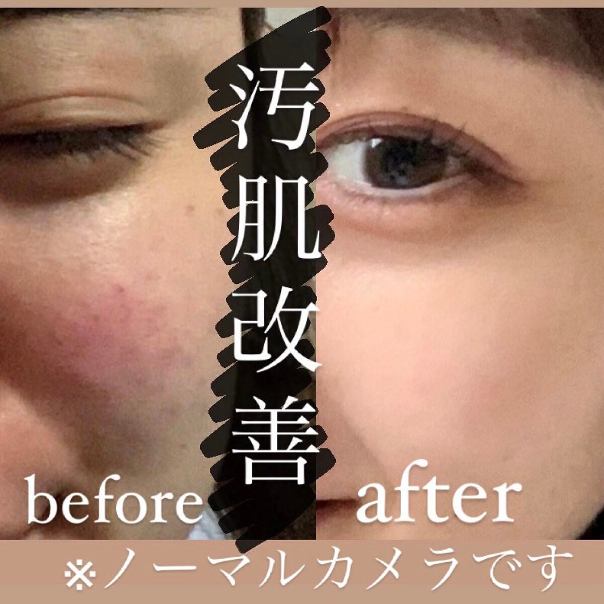 ガラクナイアシン2.0エッセンス/manyo/美容液を使ったクチコミ(1枚目)