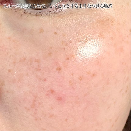 サナ リンクルターン アドバンスト 薬用リペア グロウハイドレーター【医薬部外品】/サナ リンクルターン/化粧水を使ったクチコミ(4枚目)