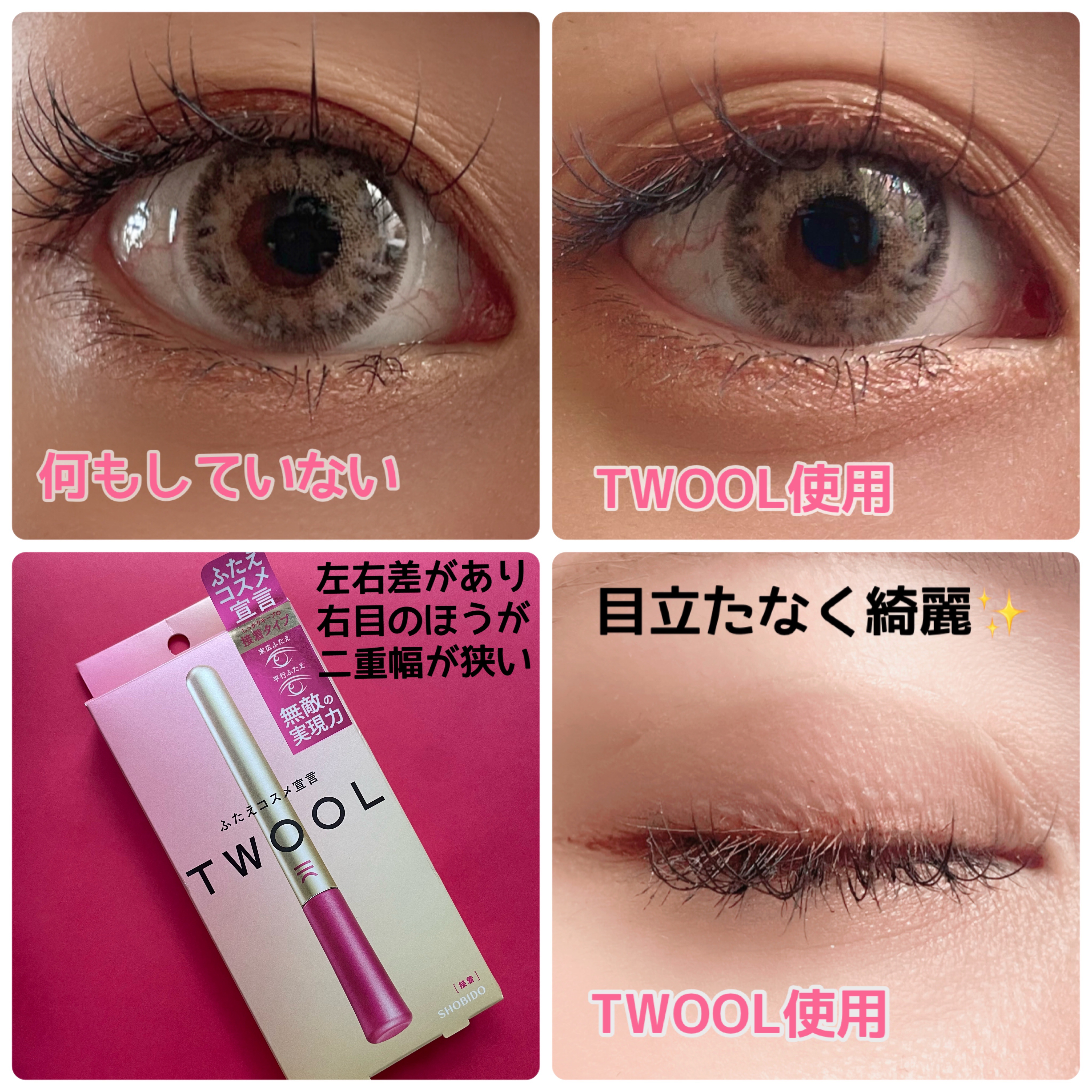 TWOOL ダブルアイリッドグルー/SHOBIDO/二重まぶた用アイテムを使ったクチコミ（3枚目）