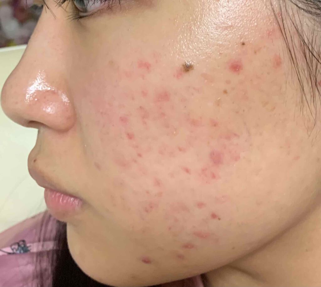 クリアウォッシュ/オルビス/洗顔フォームを使ったクチコミ（2枚目）