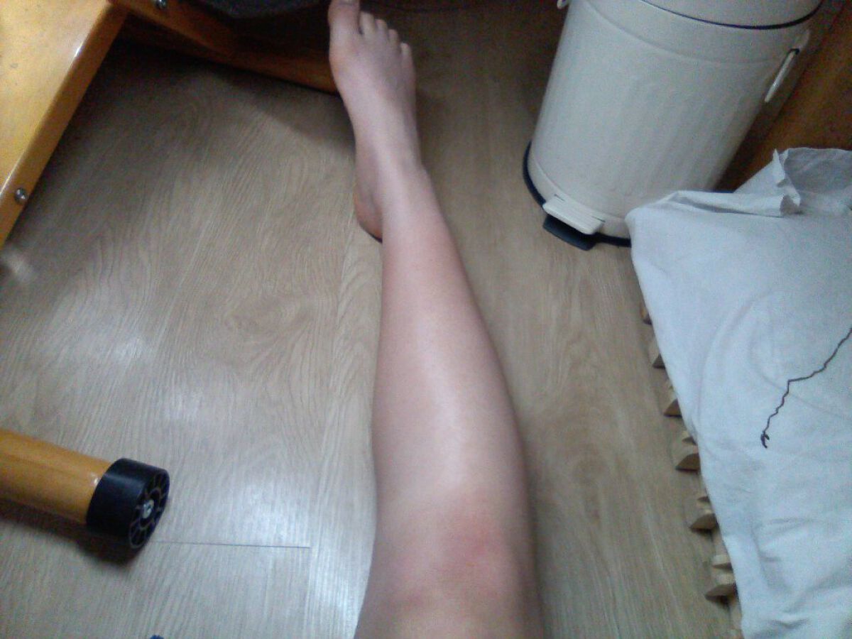 ハトムギ化粧水(ナチュリエ スキンコンディショナー R )/ナチュリエ/化粧水を使ったクチコミ（2枚目）