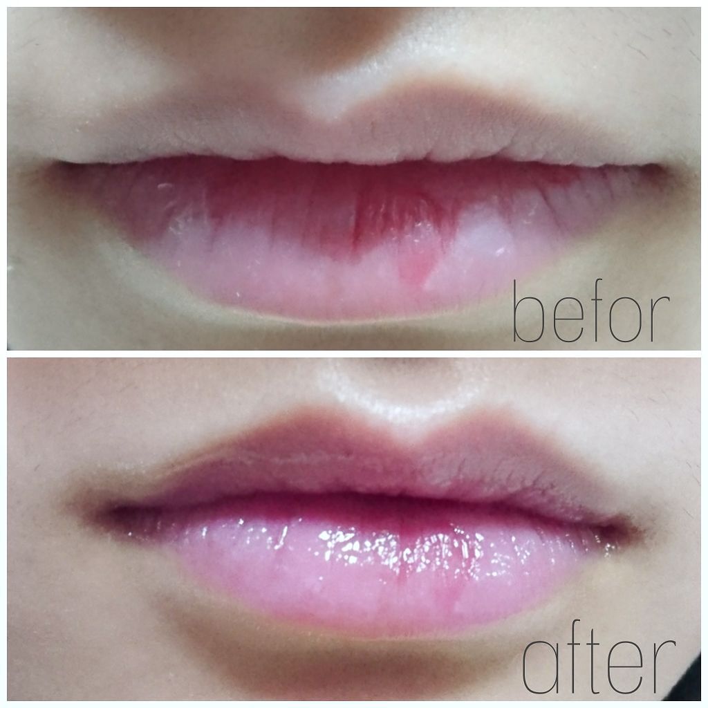 ベビーワセリンリップ/健栄製薬/リップクリームを使ったクチコミ(2枚目)