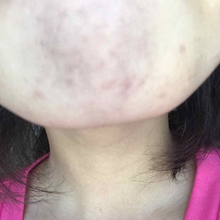 スキンケア洗顔料 オイルコントロール/ビオレ/洗顔フォームを使ったクチコミ(4枚目)