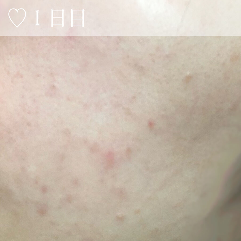 ジルスチュアート リップバーム/JILL STUART/リップバームを使ったクチコミ（2枚目）