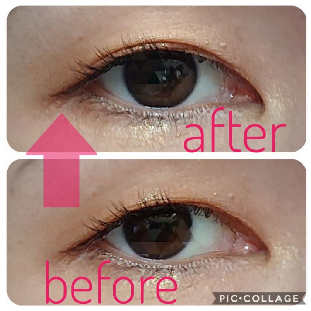 ハイブリッドフィルム/アイトーク/二重まぶた用アイテムを使ったクチコミ(2枚目)