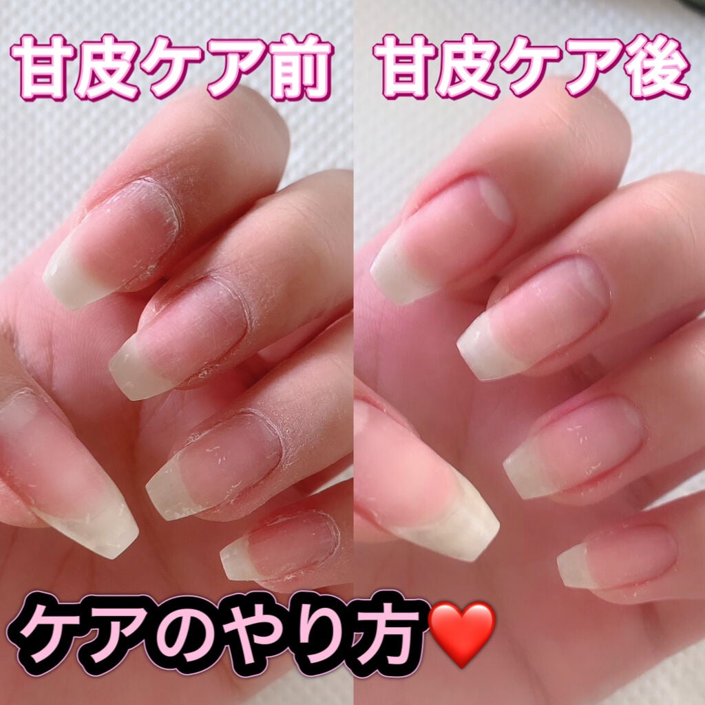 キューティクルリムーバー/BLUECROSS/ネイルオイル・トリートメントを使ったクチコミ(1枚目)