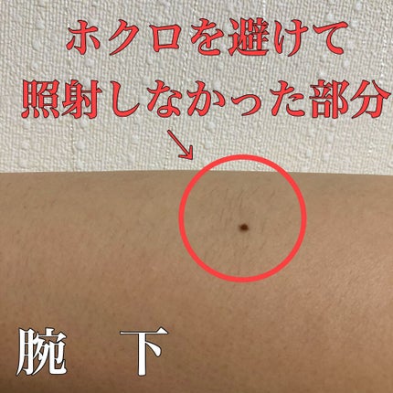 光美容器 光エステ ボディ&フェイス用 ハイパワー ゴールドES 光美容器 光エステ ボディ&フェイス用 ハイパワー ゴールドES