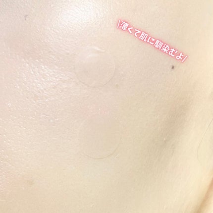 キャッチミーパッチ/CATCH ME PATCH/にきびパッチを使ったクチコミ(5枚目)