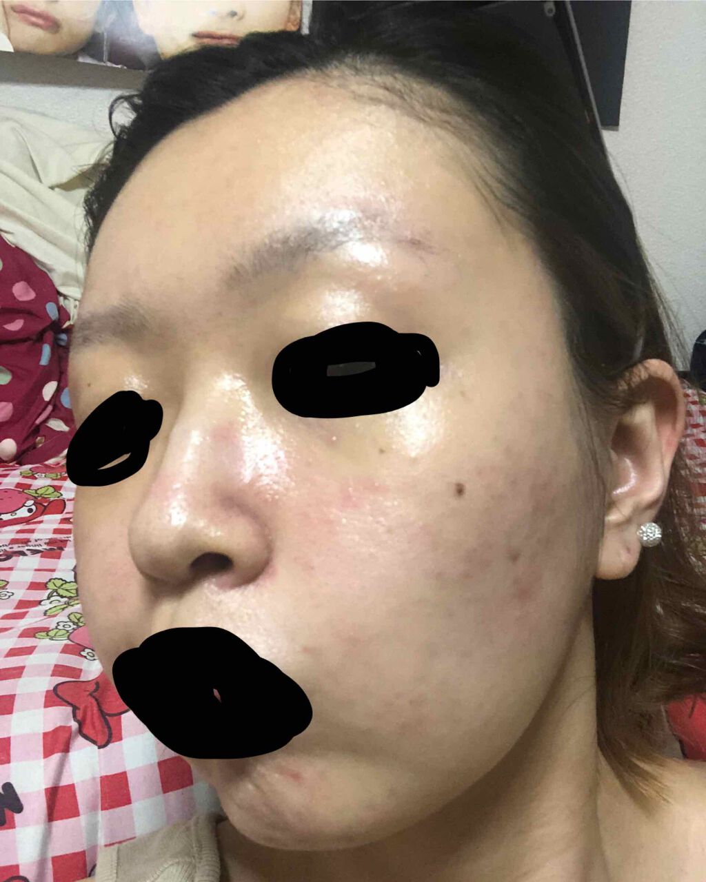 Sparksound on LIPS 「肌荒れメモ3月後半から肌荒れしだして湿疹みたいなの繰り返して皮..」(3枚目)