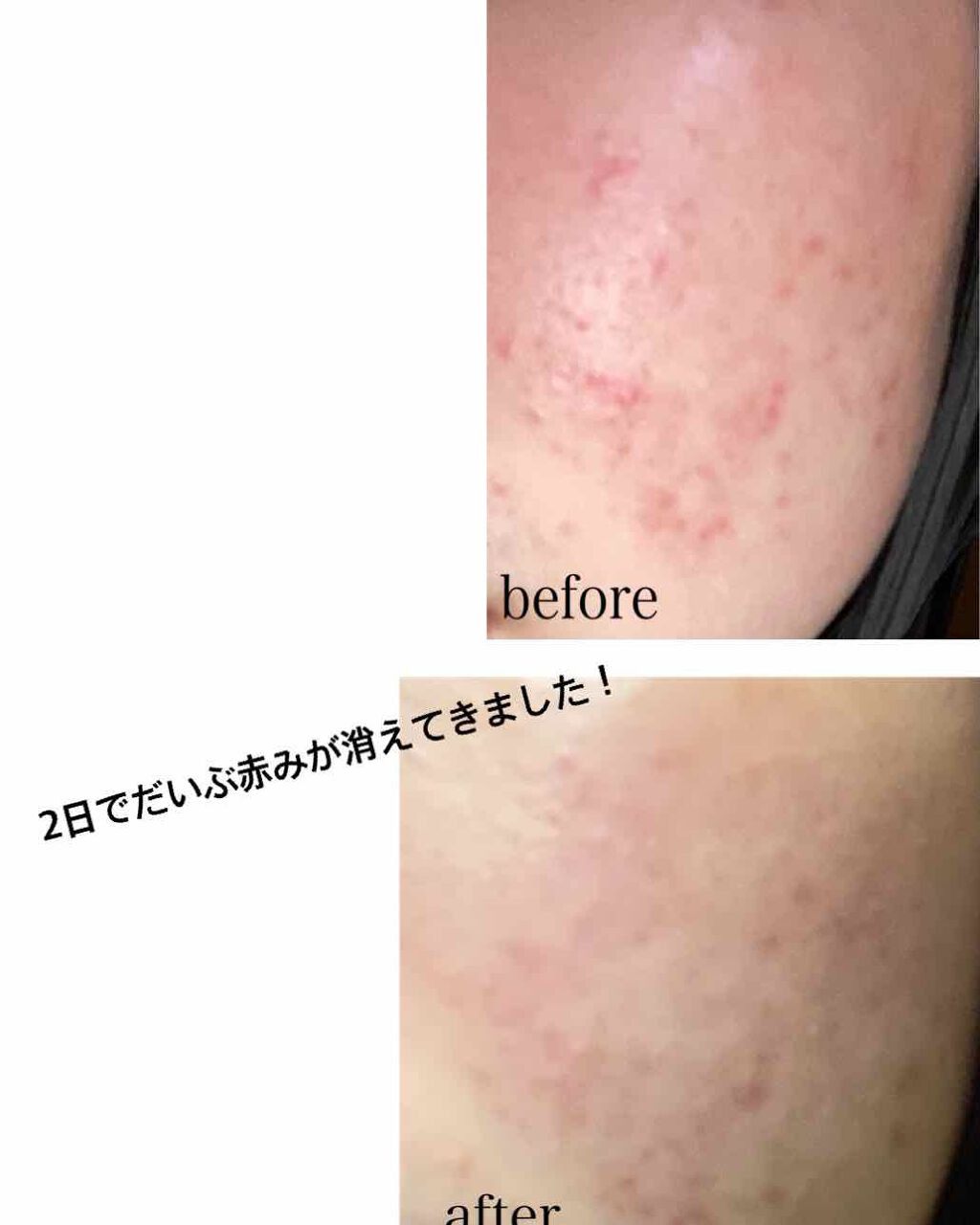 スクワビューティ 素肌いきいき美容液マスク/スクワビューティー/シートマスク・パックを使ったクチコミ(2枚目)