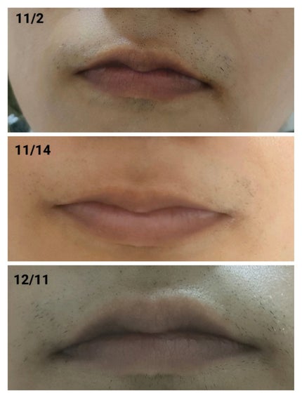 を使ったクチコミ(2枚目)