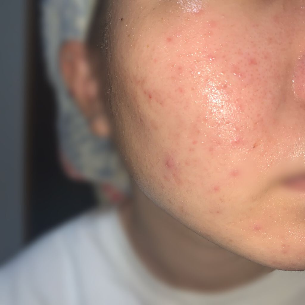 ロゼット洗顔パスタ 海泥スムース/ロゼット/洗顔フォームを使ったクチコミ（2枚目）