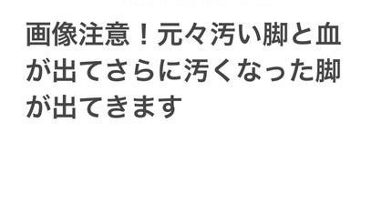 bi-hada ompa L ホルダー替刃2個付/貝印/シェーバーを使ったクチコミ(1枚目)