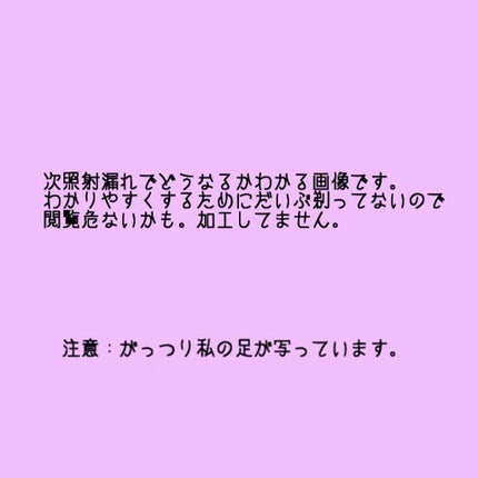 FASIZ607C IPL光脱毛器/FASIZ/家庭用脱毛器を使ったクチコミ(7枚目)