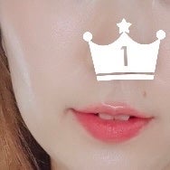 タカミスキンピール/タカミ/ブースター・導入液を使ったクチコミ(1枚目)