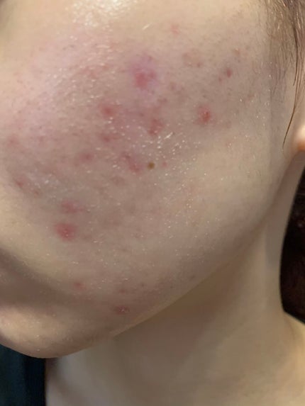 ãããªã²ã«/ãã«ãæ ªåŒäŒç€Ÿ/ãã®ä»ã䜿ã£ãã¯ãã³ãïŒ2æç®ïŒ