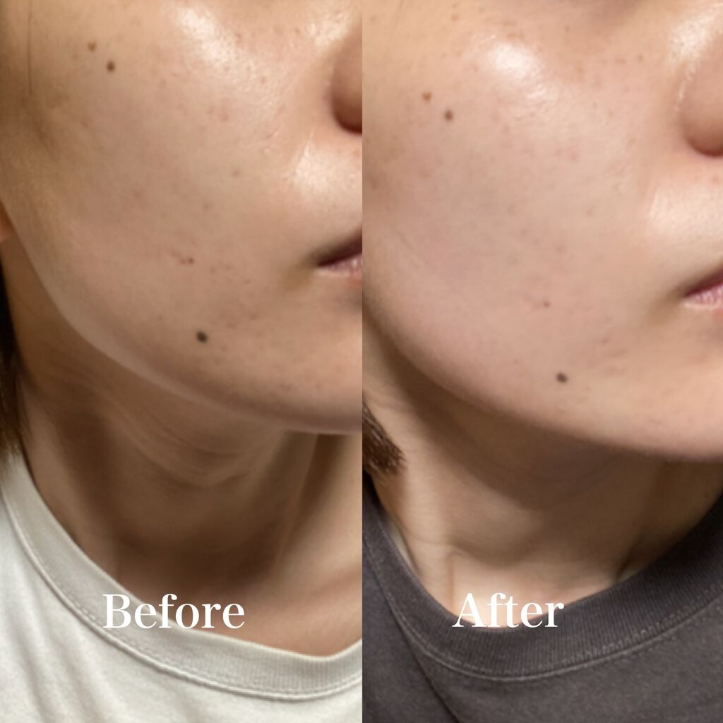 エクサージュホワイト ホワイトライズ ミルク/ALBION/乳液を使ったクチコミ(2枚目)