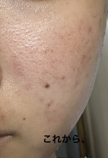 ファブール リフトエッセンスブースターＣＣ/FAVEUR/美容液を使ったクチコミ（2枚目）