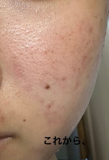 ファブール リフトエッセンスブースターCC/FAVEUR/美容液を使ったクチコミ(2枚目)