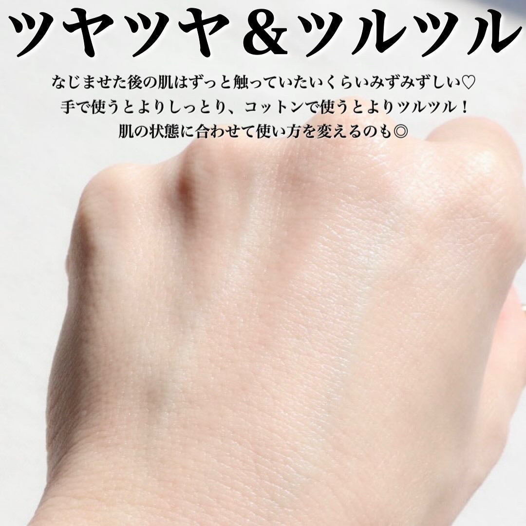 オイデルミン エッセンスローション/SHISEIDO/化粧水を使ったクチコミ(6枚目)