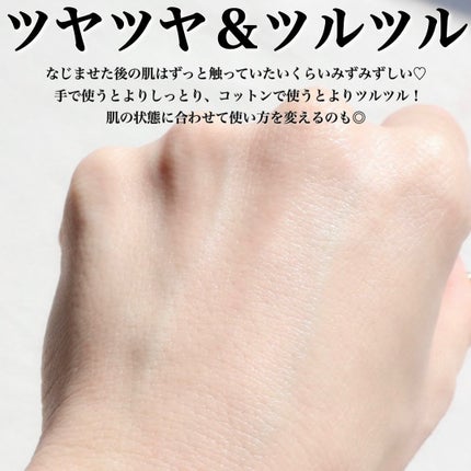 オイデルミン エッセンスローション/SHISEIDO/化粧水を使ったクチコミ(6枚目)