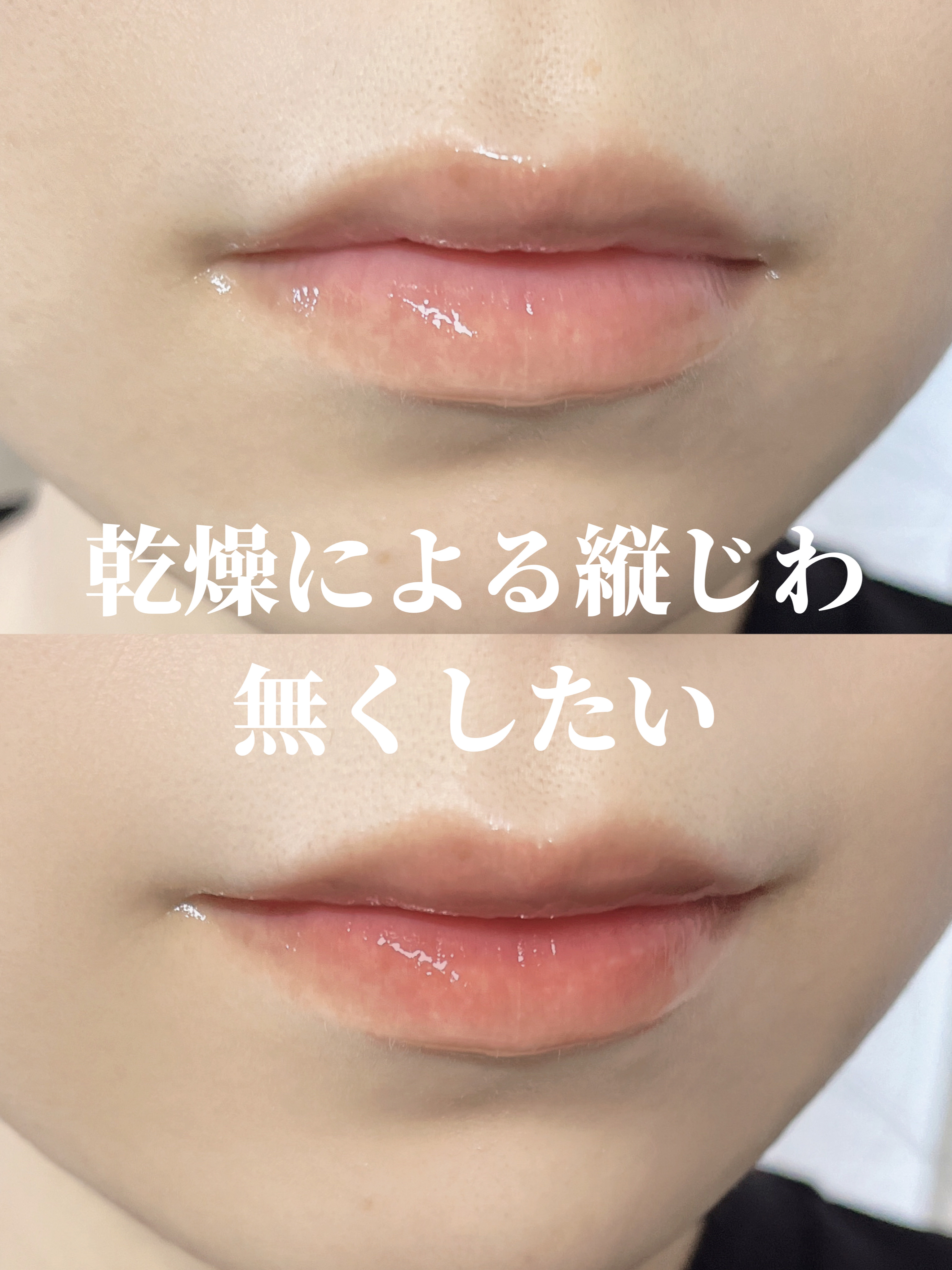 ウォンジョンヨ ケアマスターリップマスク/Wonjungyo/リップマスクを使ったクチコミ（1枚目）