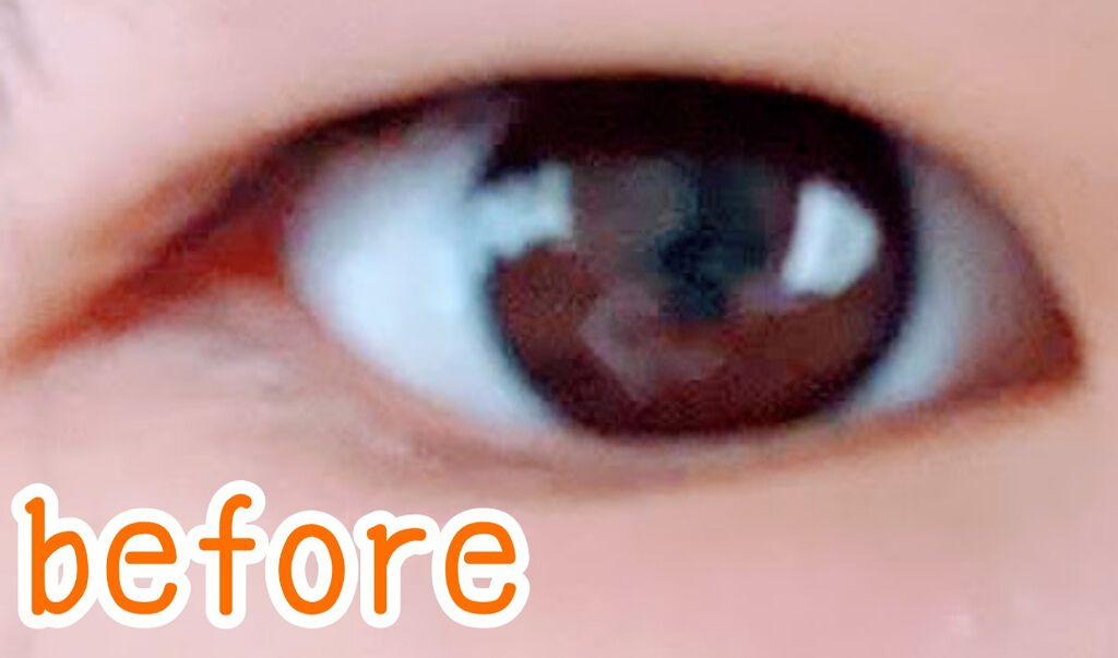 【旧品】オリシキ アイリッドスキンフィルム/D-UP/二重まぶた用アイテムを使ったクチコミ(2枚目)