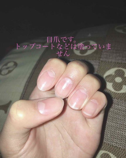 ベビーオイル 無香料/ジョンソンベビー/ボディオイルを使ったクチコミ(1枚目)