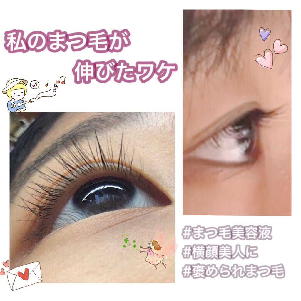 アヴァンセ ラッシュセラム EX(医薬部外品)/アヴァンセ/その他を使ったクチコミ(1枚目)