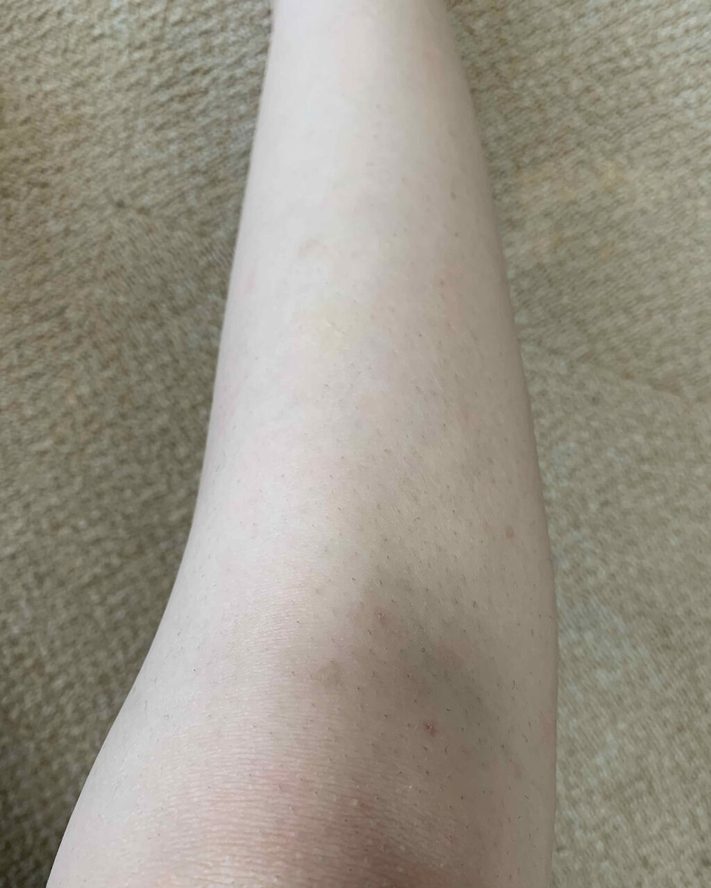 脱毛クリーム MOOMO/自然化粧品研究所/除毛クリームを使ったクチコミ（3枚目）