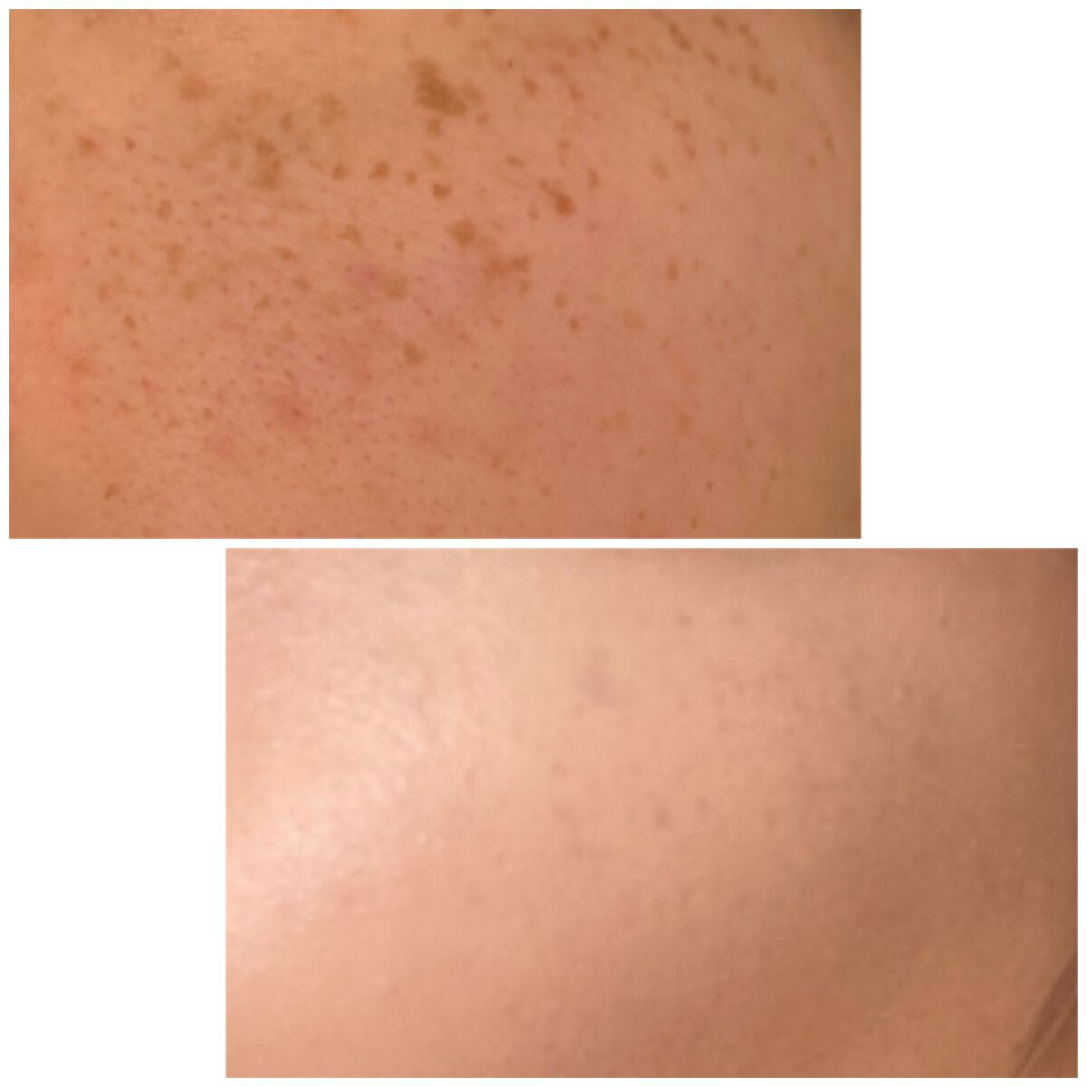 【旧】ディオールスキン フォーエヴァー スキン コレクト コンシーラー/Dior/リキッドコンシーラーを使ったクチコミ(2枚目)