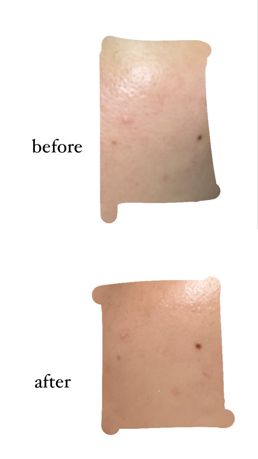 CICA デイリースージングマスク/VT/シートマスク・パックを使ったクチコミ(3枚目)