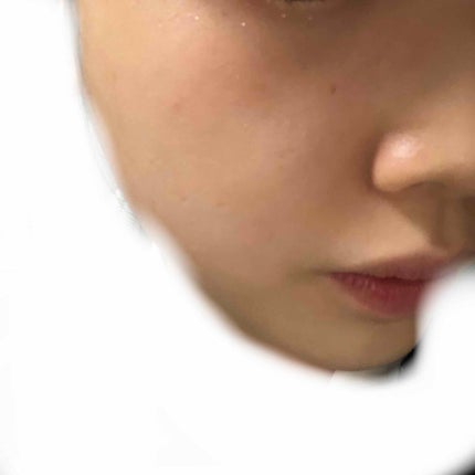 マシュマロホイップ 薬用アクネケア/ビオレ/泡洗顔を使ったクチコミ(3枚目)