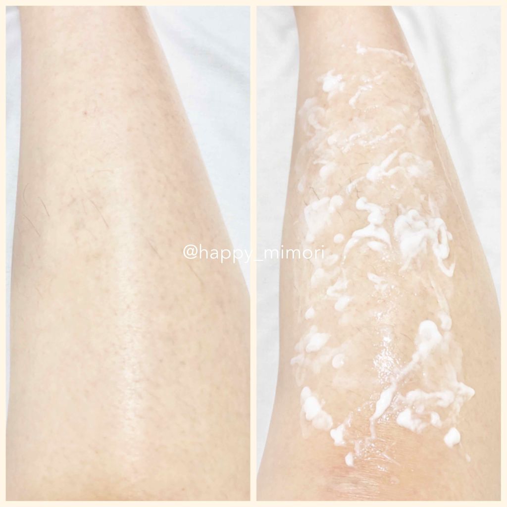 deleMO/deleMO/除毛クリームを使ったクチコミ（2枚目）