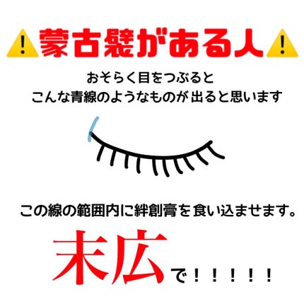るにょ on LIPS 「こんにちは🌐🤍今回は私の二重のなり方についてです(◜ᴗ◝)蒙古..」(4枚目)