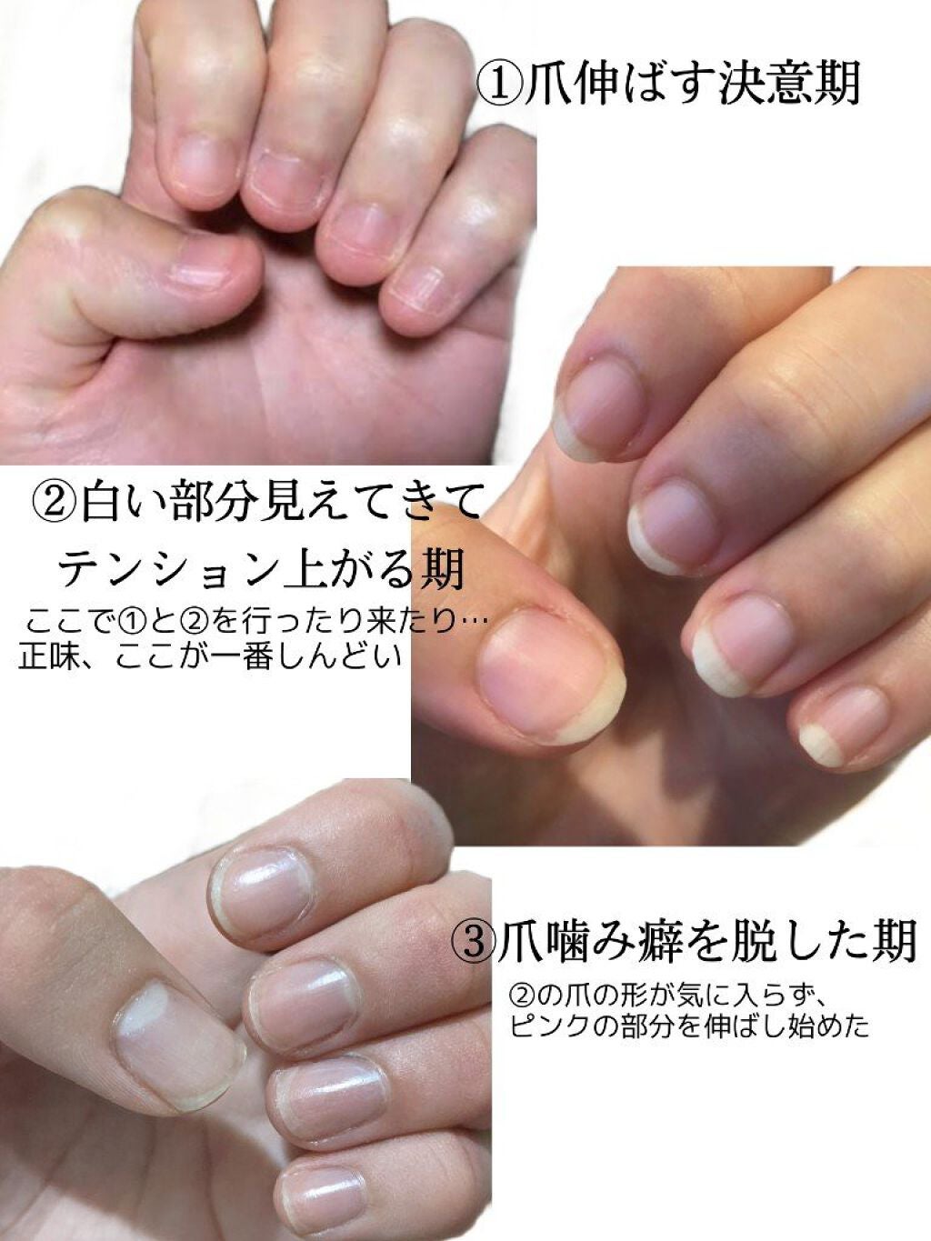 ã¢ã¡ð¬ on LIPS ãæåã«èšã£ãšããŸããçªåã¿çã¯çµ¶å¯ŸçŽããïŒïŒïŒïŒ(ãšããããçª..ãïŒ2æç®ïŒ