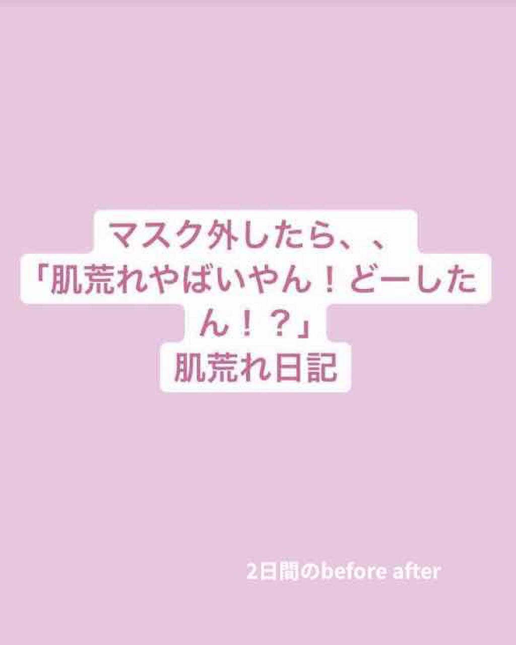 ローション/キュレル/ボディローションを使ったクチコミ(1枚目)